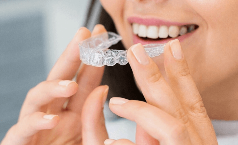 Invisalign vs. Traditional Braces: Pros, Cons, and What to Choose