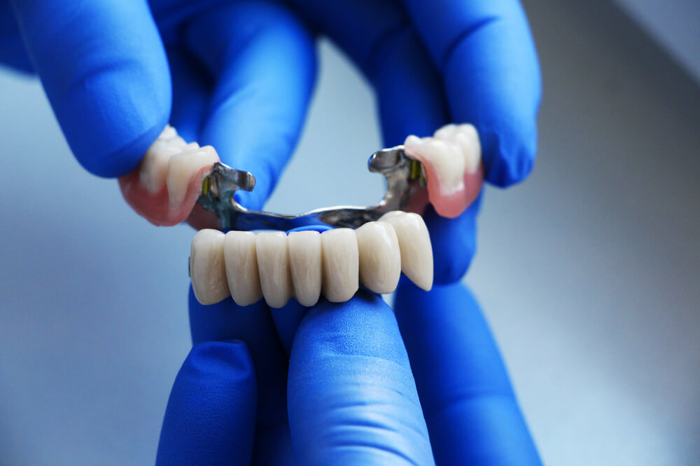 Dental Bridge in Oakville