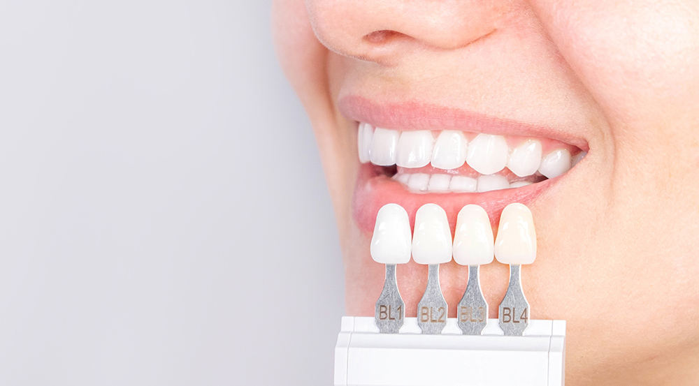 Dental Crowns in Oakville