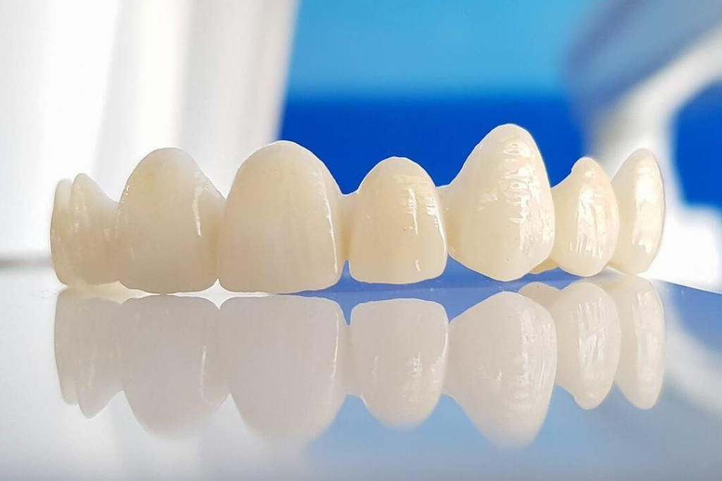 Dental Crowns in Oakville