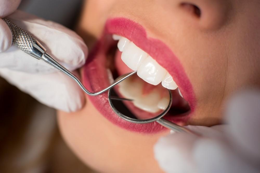 Teeth Cleaning in Oakville