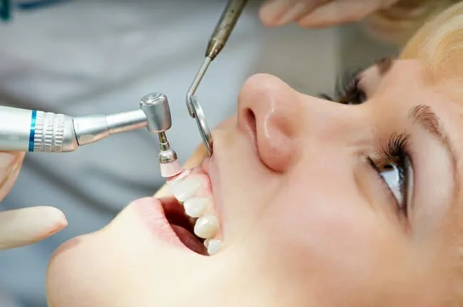 Teeth Cleaning in Oakville
