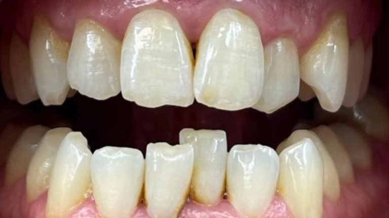 WhatsApp-Image-2025-06-11-at-10.10