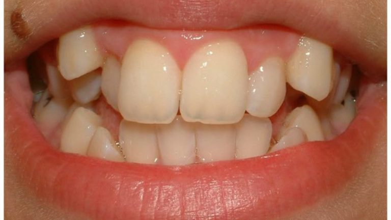 WhatsApp-Image-2025-06-11-at-10.10