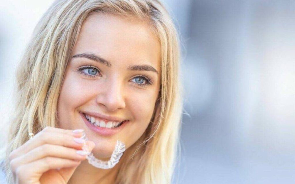 Smile Makeover in Oakville - Invisalign