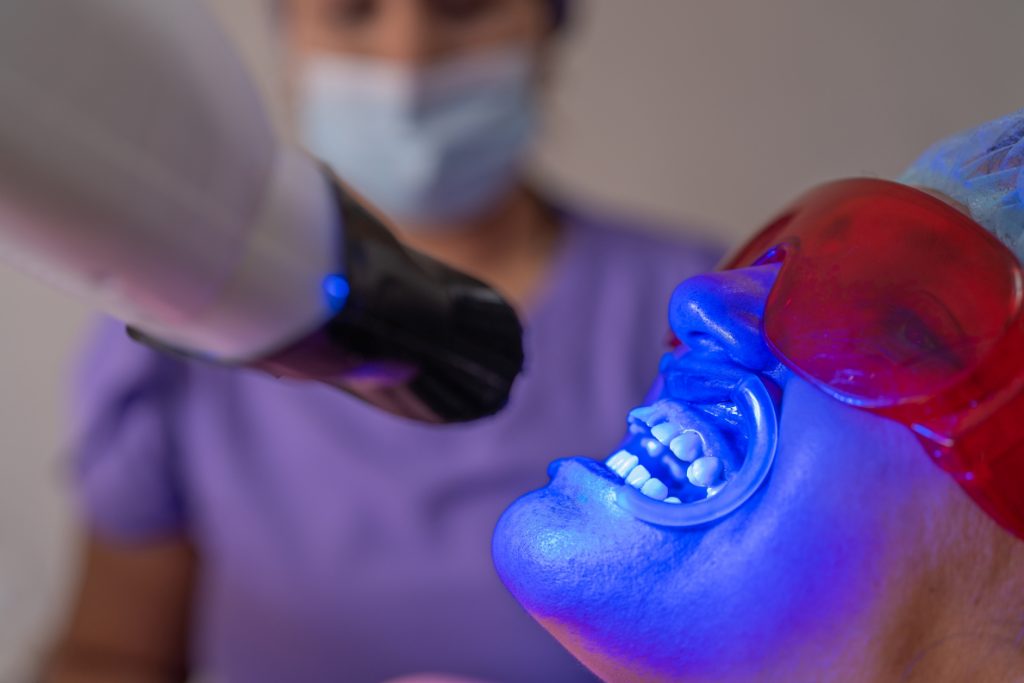 Teeth Whitening in Oakville