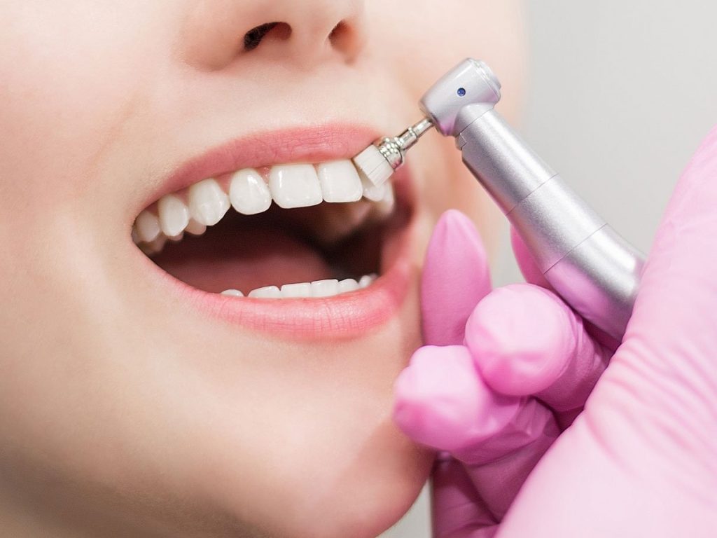 Teeth Whitening in Oakville