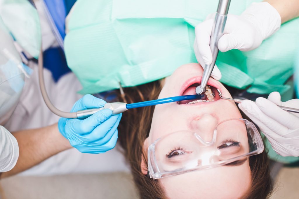 Root Canal Treatment in Oakville