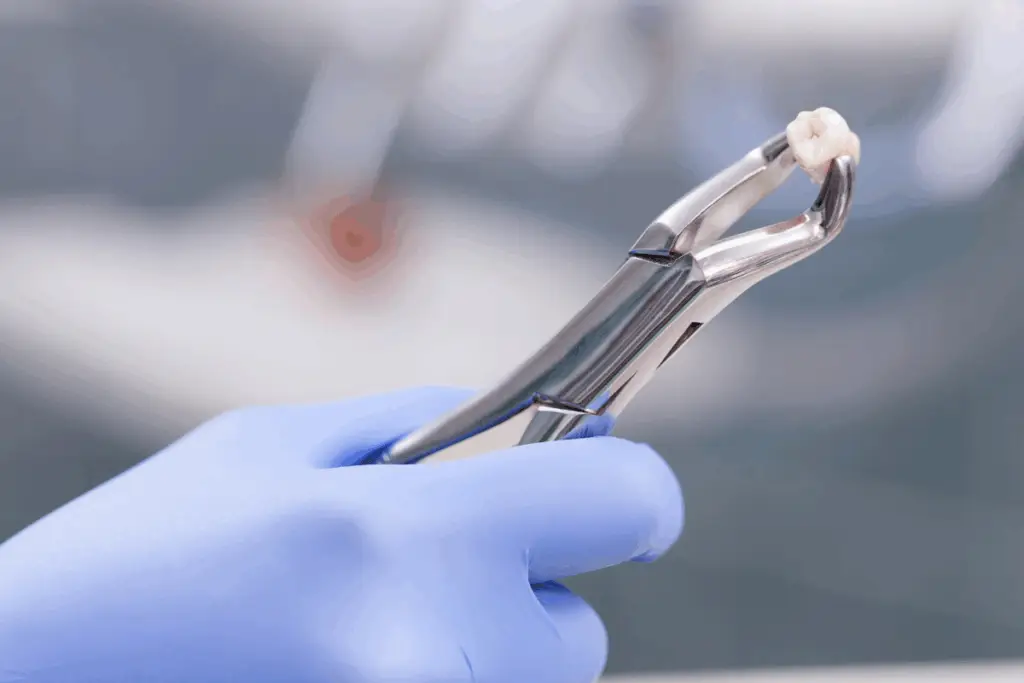 Tooth Extractions in Oakville