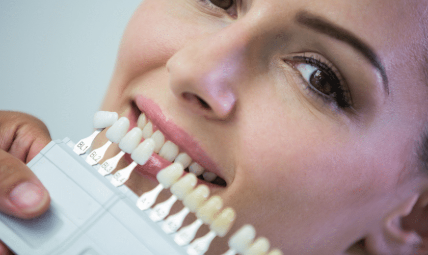Dental Veneers in Oakville