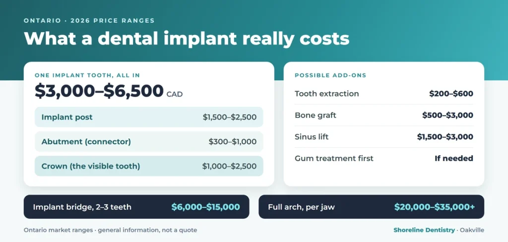 Dental implant cost breakdown in Ontario for 2026, showing the implant post, abutment, crown, and common add-on procedures